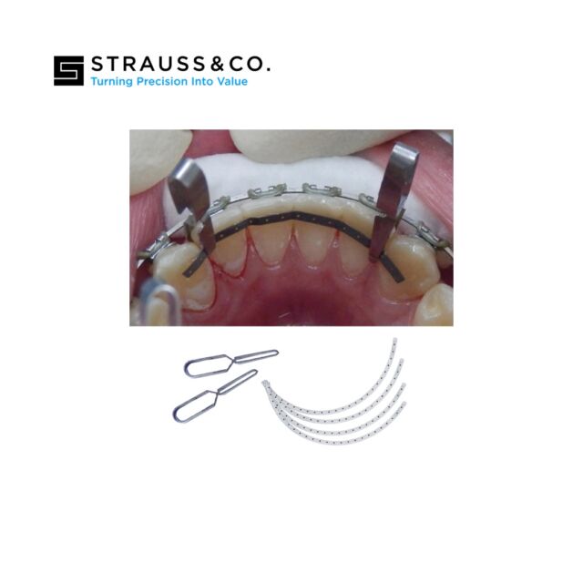 חוט קיבוע-סט (10) Strauss Lingual Retention Kit